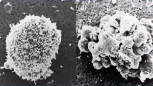电镜下的“正常细胞”和“衰老细胞”