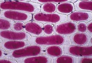 质壁分离的洋葱鳞片表皮细胞
