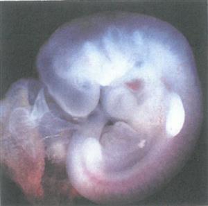 人的胚胎经历有尾阶段